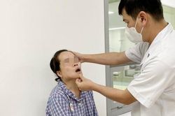 Giải cứu người phụ nữ 8 năm mang khối u khủng trên mặt