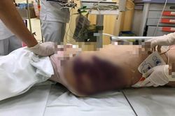 Bé gái nghi bị 'dì ghẻ' hành hạ đến chết: Cần làm rõ trách nhiệm của người bố