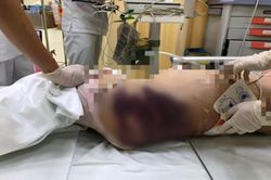 Ám ảnh câu nói của bé 8 tuổi nghi bị vợ sắp cưới của bố bạo hành đến chết: 'Mẹ ơi, mẹ không được đến thăm con đâu!'