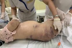 Vụ bé VA bị bạo hành đến tử vong: Nỗi buồn của người lớn