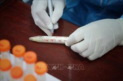 Bắc Giang phát hiện ổ dịch với nhiều ca mắc là học sinh tiểu học
