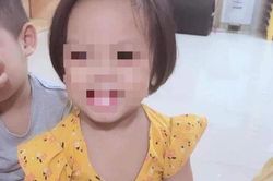 Thông tin từ bệnh viện: Bé 3 tuổi nghi bị 9 mũi đinh găm trong hộp sọ đang nguy kịch!