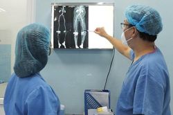 Lỡ trượt chân trong sinh hoạt, nhiều phụ nữ suýt tàn phế