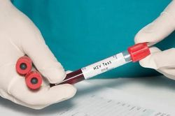 Tin mừng thế kỷ của ngành y: Người phụ nữ đầu tiên được chữa khỏi HIV nhờ liệu pháp hoàn toàn mới