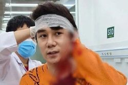 Nam diễn viên bị chém ở Hà Nội: Thương tật dưới 11% xử lý thế nào?