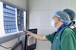 Cứu kịp thời ca ho máu nặng trên nền lao phổi, nhiễm Covid-19