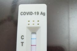 Bộ Y tế: Cho phép công nhận kết quả test nhanh do người dân thực hiện