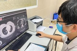 F0 uống kháng sinh phòng bội nhiễm phổi có nên hay không?