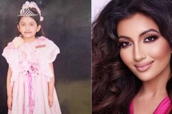 Tiết lộ bất ngờ về Á hậu 1 Miss World 2021: Từng gặp tai nạn đến biến dạng mặt