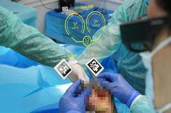 Lần đầu tiên Việt Nam đưa công nghệ thực tế ảo 'mắt thần' vào thay khớp nhân tạo