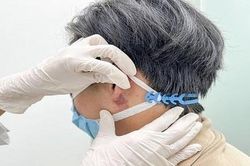 Hiểm họa từ trào lưu nam giới tạo tai Phật bằng tiêm filler