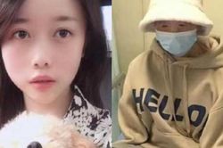 Cô gái 'bị thiêu rụi' khi ô tô tự phát cháy: Dung nhan hủy hoàn toàn, mất 2 tay và cuộc sống hiện tại khiến nhiều người bất ngờ