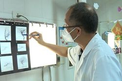 Mù mắt, co giật, tắc động mạch não vì tiêm filler làm đẹp mũi