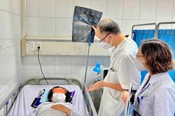 Người phụ nữ co giật, suýt mù mắt sau tiêm filler nâng mũi ở spa