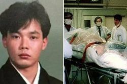 83 ngày đau đớn của người bị nhiễm phóng xạ nặng nhất thế giới