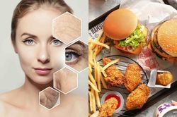 5 thực phẩm đẩy nhanh quá trình lão hóa chị em nên hạn chế