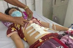 Tin thêm vụ cha dượng đánh con riêng của vợ bị dập lách, gãy xương sườn