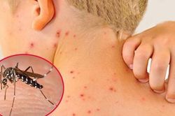 Ca mắc sốt xuất huyết tăng đột biến, nhiều trẻ nhập viện muộn bị ngưng tim, nguy kịch