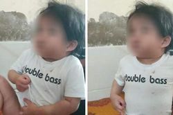 Bác sĩ báo công an sau khi bé 4 tuổi nhập viện với nhiều vết thương đáng ngờ