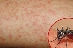 TP.HCM: Trẻ nhập viện vì sốt xuất huyết gia tăng, cảnh báo nguy cơ dịch bùng phát