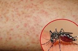 Đã có 14.700 ca mắc sốt xuất huyết, 6 trường hợp tử vong, Bộ Y tế dự báo dịch có thể gia tăng