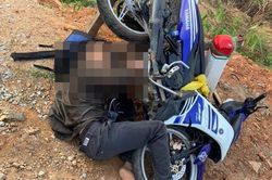 Hy hữu: Nam thanh niên bị chân chống xe máy đâm xuyên má sau tai nạn