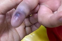 Giấu bố mẹ mua rắn về làm thú cưng ở phòng riêng, bé trai 13 tuổi ở Hà Nội phải nhập viện cấp cứu