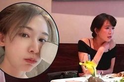 Hình ảnh lộ diện lần đầu sau sinh của Lâm Chí Linh gây bức xúc