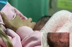 Đang đi bộ sang phòng đẻ, mẹ bầu giật mình thấy con rơi ra, nhìn em bé mà xót xa