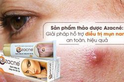Sản phẩm thảo dược Azacné: Giải pháp hỗ trợ điều trị mụn nang an toàn, hiệu quả