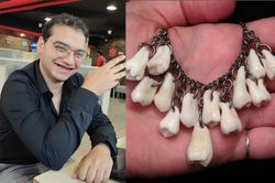 Anh chàng nhổ răng làm vòng tặng bạn gái để bày tỏ tình cảm và sự thật ngã ngửa