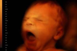 Em bé trong bụng mẹ 90% thời gian là ngủ, thức dậy lại làm 'đủ trò' cực đáng yêu