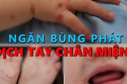 Ngăn bùng phát dịch tay chân miệng