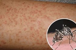 Khả năng sốt rét lây lan vào Việt Nam là rất thấp