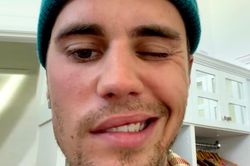 Justin Bieber hoãn tour diễn vì gặp virus hiếm khiến nửa mặt bị liệt