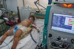 Thiếu hụt thuốc đặc hiệu cho bệnh nhân sốt xuất huyết nặng