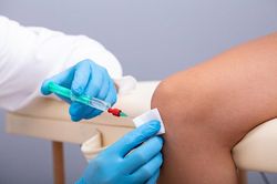 Hoại tử ruột, nhiễm trùng máu và tim do tiêm giảm đau vào khớp