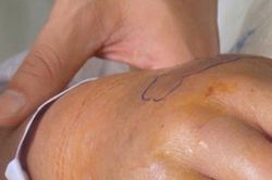 Chơi trốn tìm với bạn, bé gái 5 tuổi bị rắn cắn tử vong