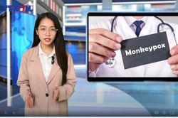 Bệnh đậu mùa khỉ lây nhiễm như thế nào?