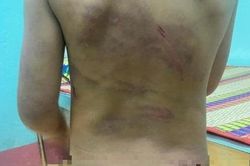 Bé gái 7 tuổi nghi bị bạo hành ở Bình Phước sống cùng mẹ và cha dượng