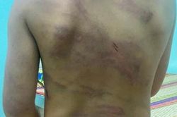 Cơ quan chức năng vào cuộc xác minh vụ bé gái 7 tuổi nghi bị bạo hành