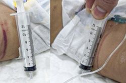 Sức khỏe bé gái 18 tháng tuổi nghi bị bạo hành tại Hà Nội giờ thế nào?