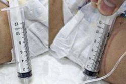 Thông tin mới nhất vụ bé gái 18 tháng tuổi bị cặp vợ chồng trẻ hành hạ dã man
