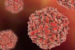 New York phát hiện virus bại liệt trong nước thải