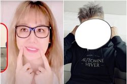 Không chỉ Hari, một nghệ sĩ Việt cũng tưởng mất sự nghiệp vì bị liệt nửa mặt
