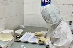 Quy định mức giá dịch vụ xét nghiệm SARS-CoV-2 không thuộc phạm vi thanh toán của Quỹ bảo hiểm y tế