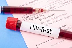 Nhiễm HIV sau khi đi xăm ở Ấn Độ