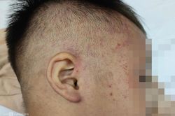 Sức khỏe bé hơn 3 tuổi nghi bị bạo hành, nhốt trong tủ cấp đông hiện thế nào?