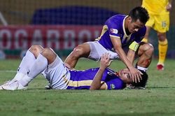 Đức Huy khâu 3 mũi ở vùng đầu