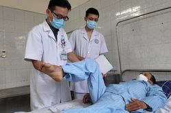 Gãy cột sống, liệt tủy do ngã từ nóc nhà cao 6m